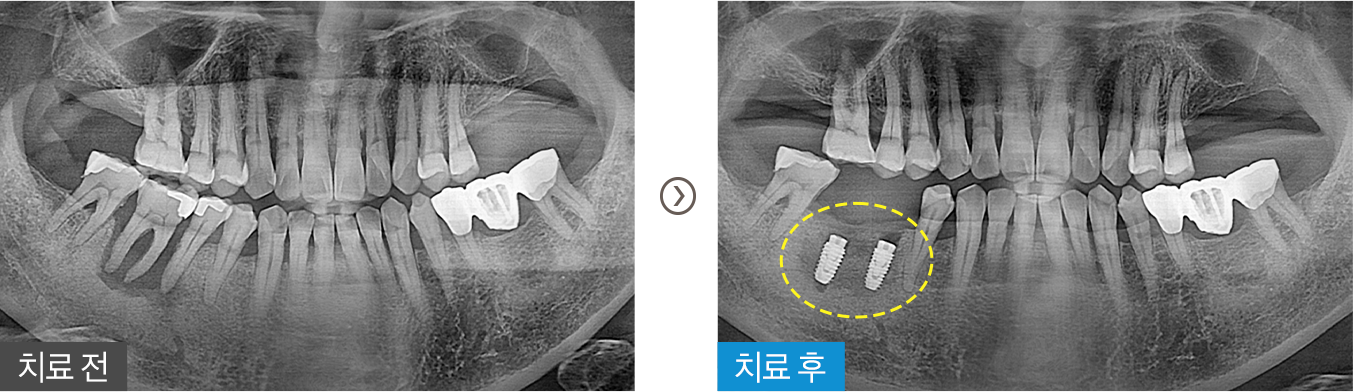 미소진치과의 통증 저감 시스템