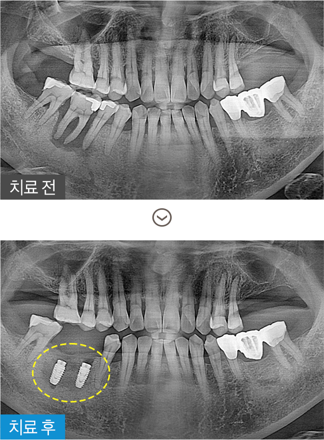 미소진치과의 통증 저감 시스템