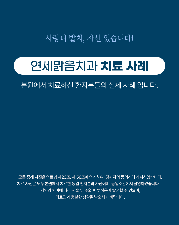 M)연세맑음치과_본랜딩_03-사랑니발치_02