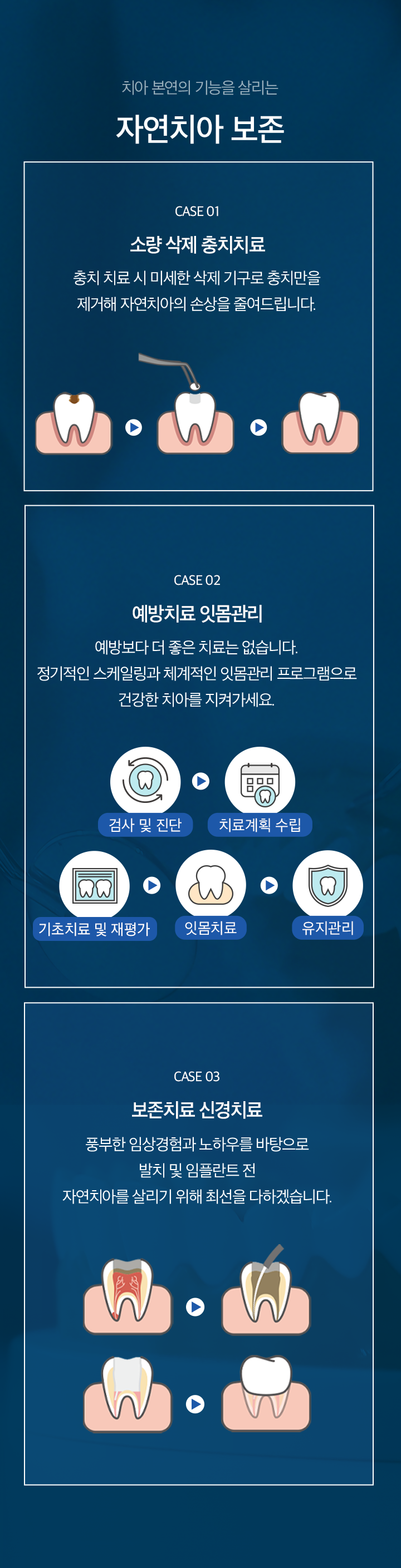 M)연세맑음치과_본랜딩_04-자연치아-살리기_03