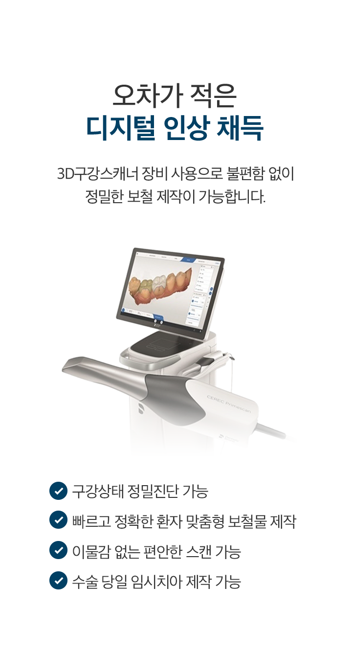 mo_오차가적은