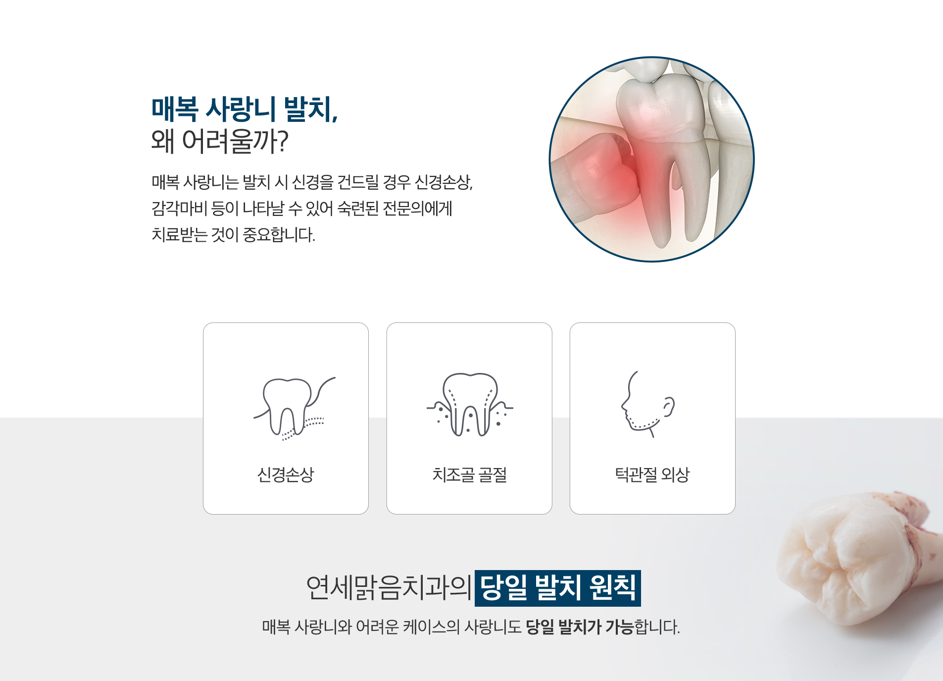 매복사랑니발치-왜-어려울까