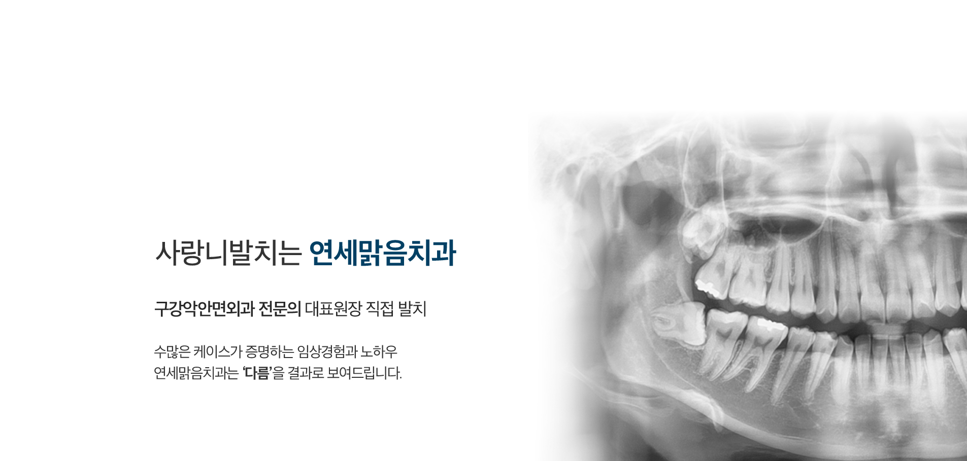 사랑니발치_bg